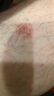 鄭修堂癬百靈草本乳膏手足肌膚止癢干燥潤膚脫皮抑菌問(wèn)題肌膚呵護 鄭修堂癬百靈1瓶 30g 1瓶 曬單實(shí)拍圖