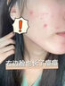DR.XME 向美博士硫磺洗面奶深層清潔控油螨蟲黑頭縮毛孔去祛潔面乳洗臉皂男女士 硫磺洗面奶【1支裝/100g】 曬單實(shí)拍圖