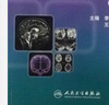 骨骼肌肉系統(tǒng)影像解剖學(xué)（第2版）：下肢卷 曬單實(shí)拍圖