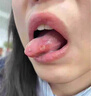 蓬仁藥業(yè)口腔潰瘍修復(fù)凝膠口腔潰瘍專(zhuān)用的藥口舌生瘡上火兒童可搭口腔潰瘍貼可搭口腔潰瘍散西瓜霜口腔潰瘍噴劑一點(diǎn)靈 曬單實(shí)拍圖