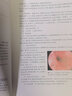 消化系統(tǒng)常見疾病診療思維 2023年4月參考書 9787117346504人民衛(wèi)生出版社 曬單實(shí)拍圖