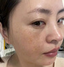唐貢金方化瘀祛斑膠囊40粒*4盒黃褐斑專用藥粉刺痘痘內(nèi)調(diào)理中藥雀斑淡化斑色斑排毒非精華霜非片 曬單實拍圖