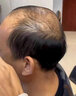 薇麗假發(fā)男短發(fā)全真人發(fā)男士頭頂補發(fā)片自然無痕遮發(fā)際線清爽毛寸 蠶絲內(nèi)網(wǎng)【16*18】毛寸 黑色系 曬單實拍圖