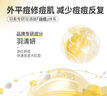 羽素安修祛痘面膜保濕修護(hù)舒緩肌膚男女學(xué)生面膜 祛痘面膜2盒 曬單實(shí)拍圖