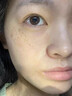 SKISGEM德國進(jìn)口美白祛斑霜男女士面霜保濕乳補(bǔ)水提亮膚色淡化黑色素護(hù)膚 單瓶裝【持證美白 煥亮肌膚】 曬單實(shí)拍圖