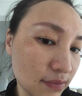 仁和匠心I同仁堂小黑瓶幽爽臻白祛斑乳霜祛斑美白淡化黑色素?zé)燉０愤m用于 2瓶同仁堂小黑瓶甄白祛斑乳霜-勻亮淡化 曬單實(shí)拍圖