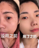 OHBT水楊酸祛痘面膜10片祛痘印修復痘坑毛孔收縮補水金榜第1名女男士 曬單實(shí)拍圖