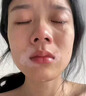 白癜風(fēng)特強效專(zhuān)用藥白癜風(fēng)外用黑色素生長(cháng)膏白斑皮膚病專(zhuān)用藥黑色素修復遮蓋神器皮膚用藥非處方藥維A酸乳膏 1盒【白癜風(fēng)特效專(zhuān)用藥膏】白癜風(fēng)外用藥 曬單實(shí)拍圖