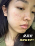 Layanana澳洲氨基酸青少年洗面奶12-16歲控油祛痘青春期學(xué)生男女孩潔面乳 曬單實(shí)拍圖
