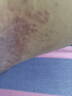 同仁堂濕疹止癢皮膚癢身體癢止癢皮炎濕疹真菌陰囊潮濕大腿癢噴劑膏 曬單實(shí)拍圖