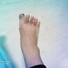有紀日本拇指外翻小趾內翻腳趾矯正拉力帶腳趾頭分離糾正分趾帶大腳骨 P款【1枚入】 曬單實(shí)拍圖