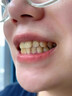 SMILEKIT日本美白牙貼去牙黃變白速效去黃去牙漬去煙漬白牙貼片亮白美牙貼 3盒裝【買(mǎi)2贈1】 曬單實(shí)拍圖