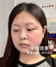 Newliann醫用械字號洗面奶狀潔面乳控油祛痘除螨蟲(chóng)去黑頭男士女士修復屏障 曬單實(shí)拍圖