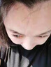 Redact澳洲抬頭紋川字紋貼去除神器額頭皺紋貼去除男女抗皺緊致衰老專(zhuān)用 曬單實(shí)拍圖