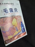 優(yōu)立特手臂毛囊炎專用噴劑肩膀長痘痘紅斑膿包胳膊上的小疙瘩丘疹疤痕N3 一盒裝【手臂毛囊炎丘疹皮膚粗糙】 曬單實拍圖