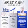 久卜制藥祛痘藥膏青春痘祛痘淡化痘印痘坑消炎痤瘡粉刺專(zhuān)用學(xué)生青少年 1盒 曬單實(shí)拍圖