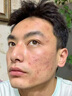 維特絲洗面奶男士專用控油祛痘黑頭收縮毛孔氨基酸提亮潔面乳金榜護(hù)膚品 曬單實(shí)拍圖