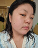 DR.CFUN德國(guó)醫(yī)用級(jí)點(diǎn)痣祛去痣點(diǎn)痣膏官方正品無痕臉部黑痣雀斑點(diǎn)痣疣藥水 【德國(guó)專研】醫(yī)用級(jí)點(diǎn)痣 | 適用于各種痣痦 曬單實(shí)拍圖