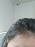 【第二代米諾地爾】蔓迪5%生發(fā)泡沫劑60g*3（倍速生發(fā) 溫和不起痘）男女士專(zhuān)用治脫發(fā)防脫育發(fā)米洛原液酊搽劑 曬單實(shí)拍圖