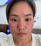 YYTISS377祛斑美白淡斑淡化黑色素藥霜黃褐斑雀斑曬斑女煙酰胺男士專用 曬單實(shí)拍圖