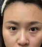 儒意（RUYI）淡紋眼霜30g淡化細紋眼紋抗皺提拉緊致黑眼圈抗祛眼袋衰老護膚品 曬單實(shí)拍圖