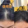 RWB卡倫雅芙防脫洗發(fā)水生姜何首烏側柏葉固定發(fā)根防脫發(fā)rwb洗發(fā)水 卡倫雅芙防脫洗發(fā)水1瓶裝 500mL 曬單實(shí)拍圖