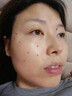 dyey點(diǎn)痣膏無(wú)痕去痣黑痣瘊子點(diǎn)痣液扁平尤絲狀尤尖尤肉刺肉兒童可用 曬單實(shí)拍圖