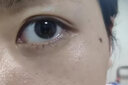 脂肪粒不去除神器眼部專(zhuān)用油脂粒脂肪粒汗管瘤眼周白色顆粒黑眼圈消，細紋精華 液 單盒裝 曬單實(shí)拍圖
