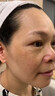YYTISS377祛斑美白淡斑淡化黑色素藥霜黃褐斑雀斑曬斑女煙酰胺男士專用 曬單實拍圖
