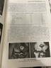 骨與關(guān)節(jié)損傷功能解剖學(xué)骨科普通外科學(xué)關(guān)節(jié)鏡實(shí)用骨科學(xué)骨質(zhì)疏松應(yīng)用解剖生物力學(xué)骨科手術(shù)學(xué)人民衛(wèi)生出版社骨科書籍 曬單實(shí)拍圖