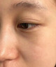 Newliann醫(yī)用重組三型人源化膠原蛋白外用人表皮生長因子凝膠皮膚疤痕修復(fù) 曬單實拍圖