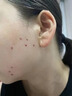 Newliann醫(yī)用重組三型人源化膠原蛋白外用人表皮生長因子凝膠皮膚疤痕修復 曬單實拍圖
