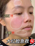 醫用冷敷貼面膜型械字號透明質(zhì)酸鈉修復貼敷料醫美術(shù)后消炎去紅美白補水曬后修復收縮毛孔祛痘控油淡化痘印 曬單實(shí)拍圖