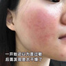 Newliann醫(yī)用重組人表皮生長因子噴霧外用修復(fù)皮膚屏障凝膠原蛋白補(bǔ)水保濕 曬單實(shí)拍圖