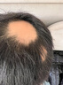 秘造防脫育發(fā)液激活毛囊增發(fā)密發(fā)長(cháng)發(fā)劑脫發(fā)嚴重專(zhuān)用營(yíng)養液頭發(fā)生長(cháng)液 【十瓶】適合多年脫發(fā)禿頂人群 曬單實(shí)拍圖