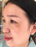YYTISS377祛斑美白淡斑淡化黑色素藥霜黃褐斑雀斑曬斑女煙酰胺男士專(zhuān)用 曬單實(shí)拍圖