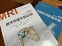 肩關(guān)節磁共振診斷：第2版 曬單實(shí)拍圖