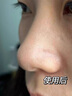 韓方五谷去黑頭鼻貼清潔泥膜祛粉刺深層清潔毛孔鼻膜神器撕拉面膜男女士 曬單實(shí)拍圖