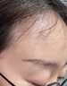 醫(yī)用痤瘡中藥去青春痘粉刺紅腫硬疙瘩痘印祛痘痘消炎痤瘡膿皰去痘印青少年涂膜劑專用清熱暗瘡?fù)琛疽曈X特效】 3盒【療程裝】 曬單實拍圖
