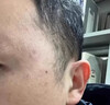 久卜制藥去疣疣體脫落膏祛疣型扁平疣絲狀疣去除疣體藥膏跖疣尖銳濕疣凝膠 曬單實(shí)拍圖