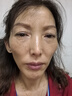 LA美國377祛斑霜美白淡化老年黃褐雀斑黑色素女男士護膚品去曬提亮 曬單實(shí)拍圖