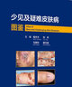 少見及疑難皮膚病圖鑒 2024年4月參考書 曬單實拍圖