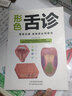 形色舌診  彩圖全解臨床圖譜 零基礎學(xué)舌診斷與調理大全中醫入門(mén)養生健康家庭保健書(shū)籍 曬單實(shí)拍圖