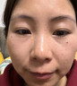 焦博士日本377祛斑霜美白淡化老年黃褐雀斑黑色素熊果苷乳膏去曬男女士 曬單實拍圖