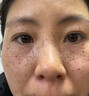 焦博士日本377祛斑霜美白淡化老年黃褐雀斑黑色素熊果苷乳膏去曬男女士 曬單實拍圖