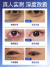LA美國(guó)眼膜眼袋貼提拉緊致抗皺淡化黑眼圈消除女男士嚴(yán)重中老年專(zhuān)用 曬單實(shí)拍圖