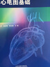 【出版社直發(fā)】臨床心臟電生理入門(mén)與起搏心電圖基礎 李忠杰 等 臨床心臟電生理入門(mén)和起搏心電圖基礎，內容主要涉及臨床心臟電生理檢查的基礎 曬單實(shí)拍圖