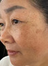 巖井昃弘祛斑霜祛斑黃褐斑雀斑曬斑男女士用的純中藥老年斑專用非藥一夜消 1盒點(diǎn)斑藥水臉部手背去老人斑醫(yī)用正品 效特白美淡斑淡化去斑去黑色素強(qiáng)力除手部臉部日本進(jìn)口 曬單實(shí)拍圖