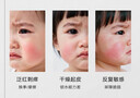 一頁(yè)兒童面霜 寶寶面霜嬰兒潤膚乳保濕面霜 緩解干癢 【超級單品】安心霜50g無(wú)香 曬單實(shí)拍圖