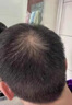 固腎生發(fā)丸治男女專用溢脂性脫發(fā)生發(fā)養(yǎng)發(fā)藥嚴(yán)重脫發(fā)頭發(fā)稀少掉頭發(fā)的藥除脂防脫發(fā)增發(fā)密發(fā)榮發(fā)白發(fā)藥品膠囊 1盒裝【固腎生發(fā)丸】掉發(fā)嚴(yán)重吃什么藥中藥調(diào)理 曬單實(shí)拍圖